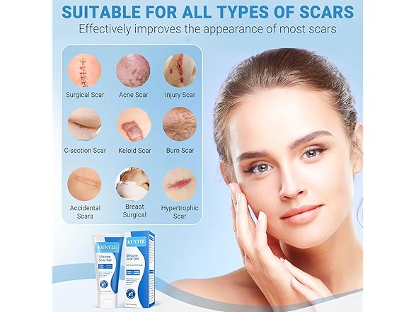 Kunyle BC521525100038 silicone scar gel