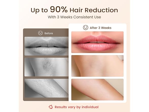 LIJAI IPL Laser Hair Removal Device