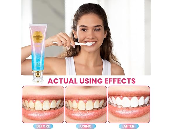 2Pk Niacinamide Whitening Toothpaste