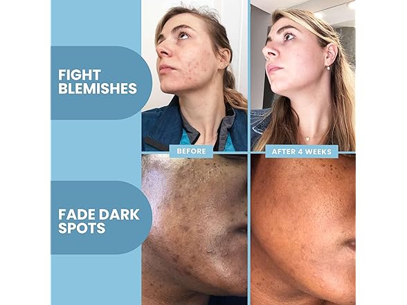 Eva Naturals Vitamin C Serum for Face