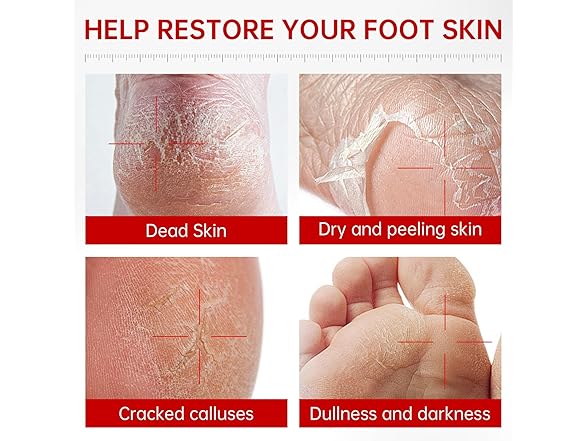 QQE Foot Peeling Mask