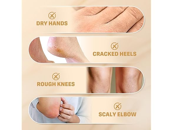 Clyecfra urea cream for feet & hands