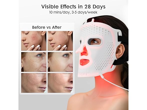 Umitec LED Face Mask Light Therapy