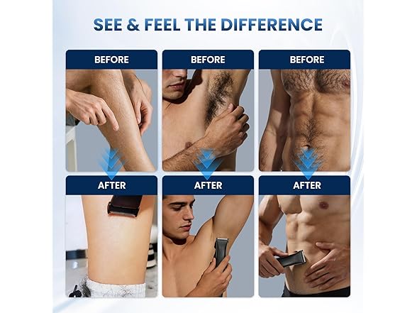 3-in-1 Body Hair Trimmer
