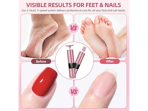 Electric Foot Callus Remover & Nail File