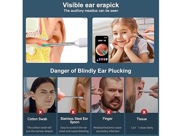 1080P HD Wifi Ear Cleaning Camera