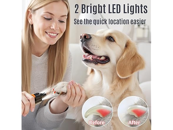 Casfuy B0FCG1FFVL dog nail grinder