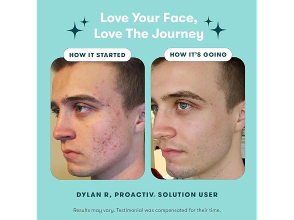 Proactiv Step Acne Treatment