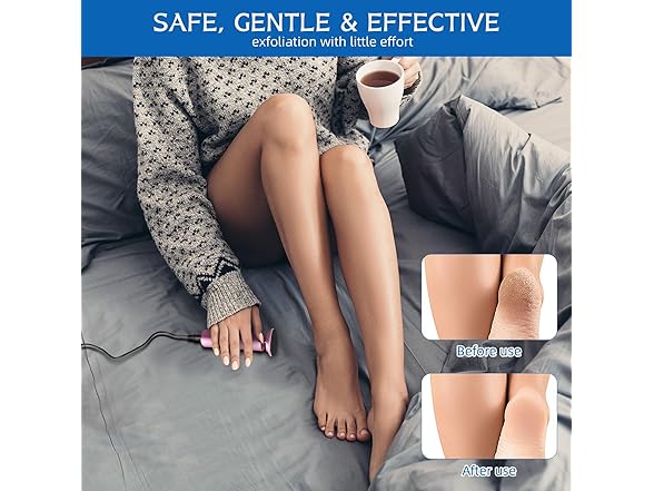 HOVGN Electric Foot File