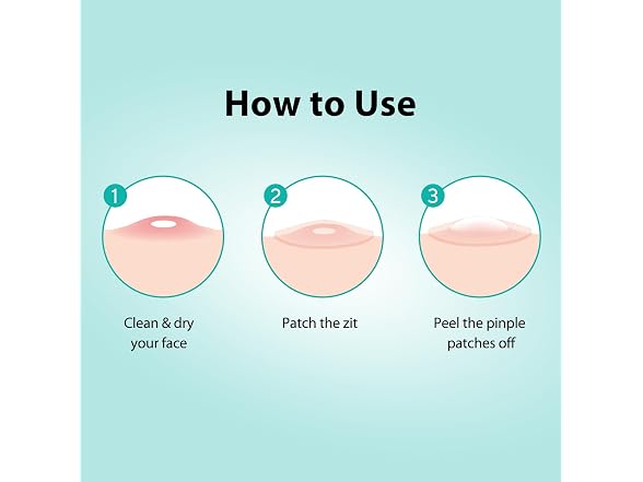 PatchCare 880pcs Pimple Patches