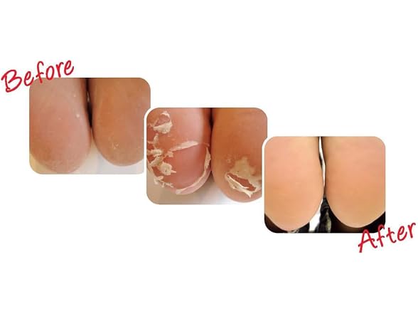 Baby Foot Original Exfoliation Foot Peel
