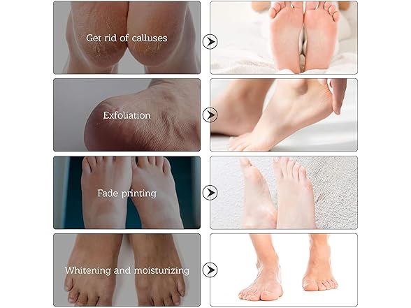 Dr.Pedi Dr.Pedi Foot Peel Mask (5 Pairs) Natural