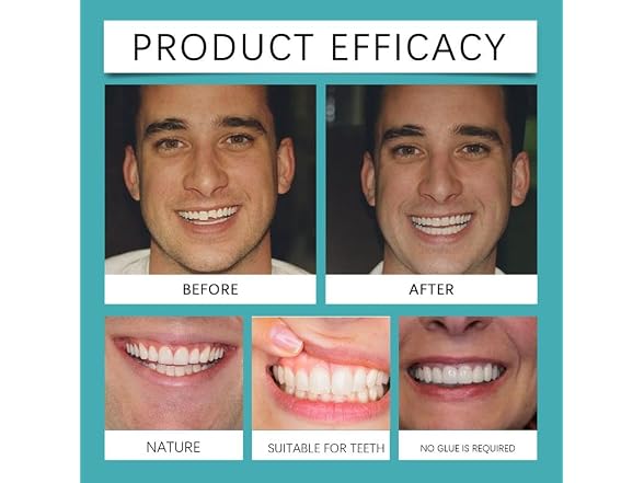 DEOLD Temporary Teeth Perfect Cover