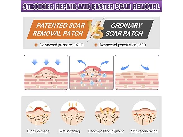 Silicone Scar Sheets (1.6"X59" Roll-1.5M)