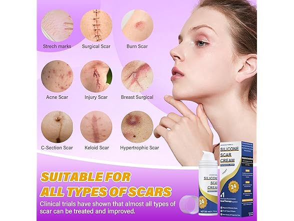 Psecici Silicone Scar Gel