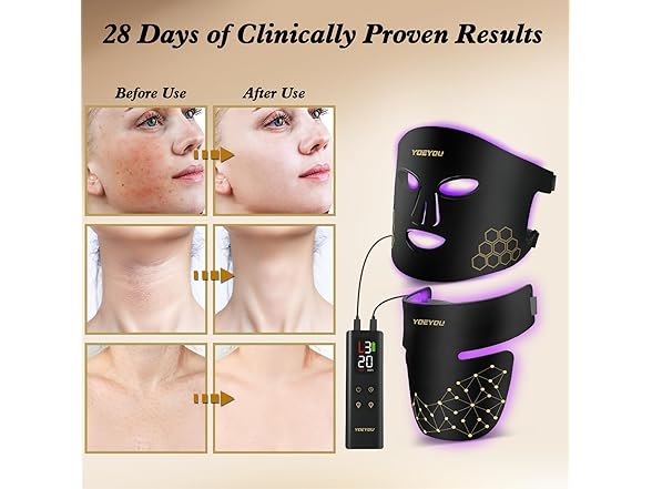 Red LightTherapy Mask Set - Gallery 4