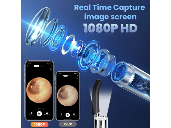 Ear Wax Removal 1080P Camera Tool