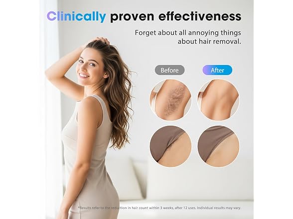 Oreeth IPL Hair Removal Device Full Body White
