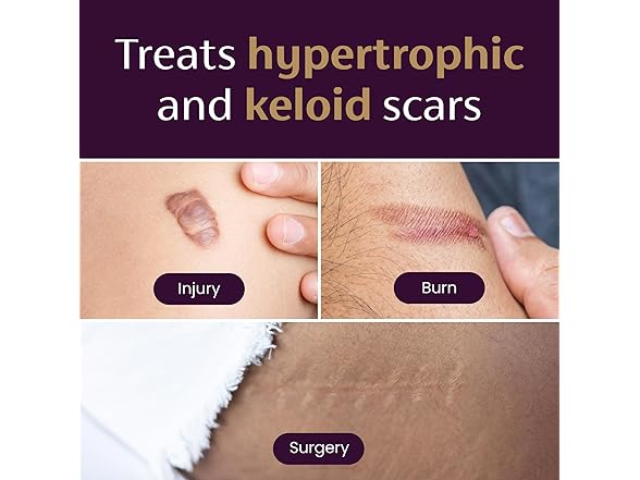 Mederma Mederma Medical Grade Silicone Scar Shee