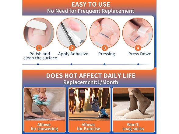 Ingrown Toenail Kit 10pc 5 Sizes