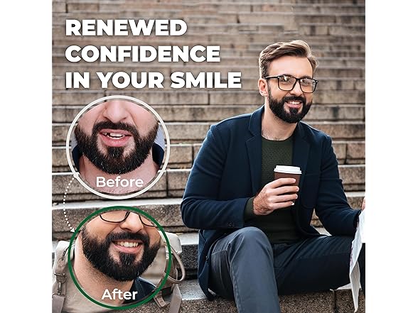 Amazing Temp Tooth Kit Natural