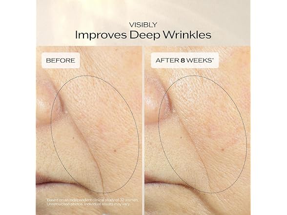 Shiseido Shiseido Vital Perfection Uplifting And Firmi