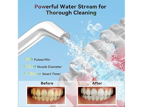 wellleo Mini Water Flosser for Teeth