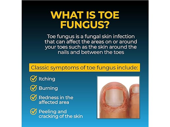 Fungi-Nail Anti-Fungal Solution 1oz