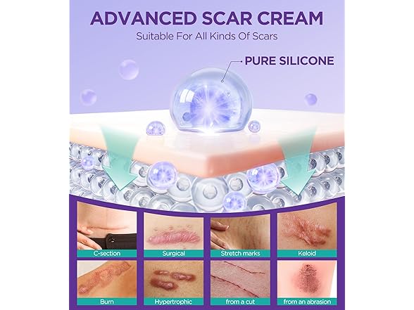 EASEWAVE Dual Action Repair Scar Cream