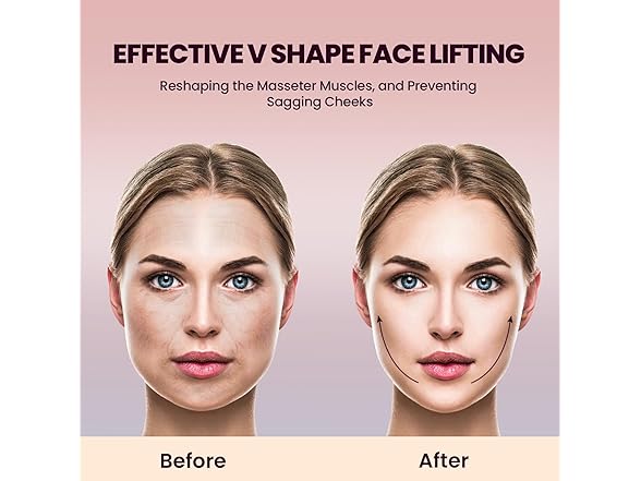 Electric Double Chin Device