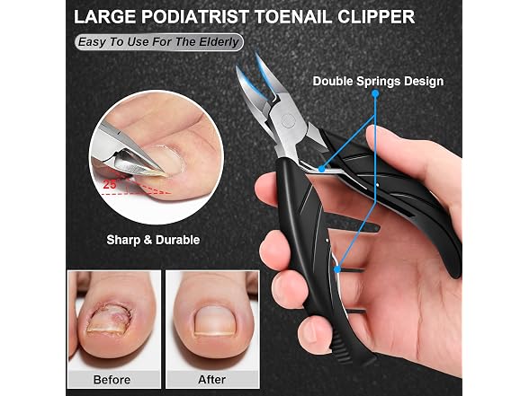 Toenail Clippers for Thick Ingrown Nails