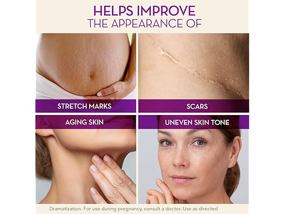 Cicatricure Cicatricure Cica Oil for Stretch Marks &