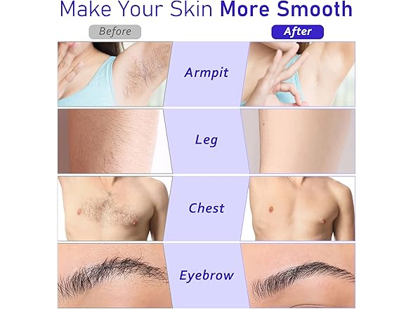 Dr.Pedi Roll on Wax Kit for Hair Removal