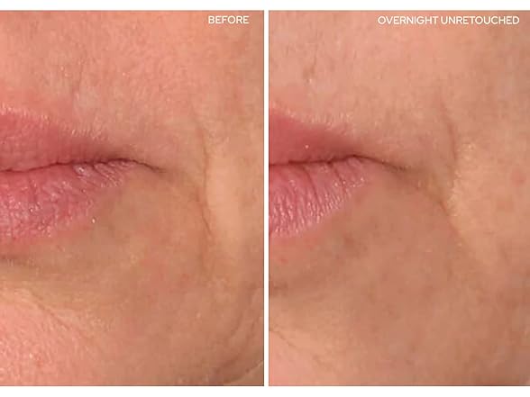 SiO Beauty Eye and Smile SuperLift