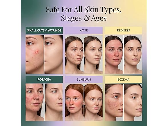 Jusspray Hypochlorous Acid Face and Skin Spray 4oz