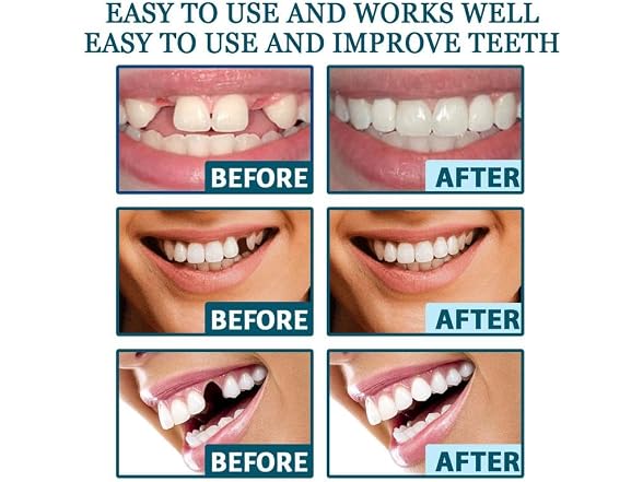 DEOLD Temporary Teeth Perfect Cover