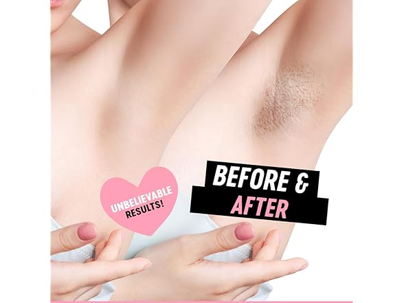 Miss Cire Ingrown Hair Prevention