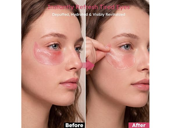 Ossjds Retinol Caffeine Eye Patches