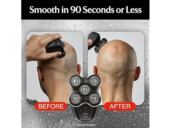 Remington Balder Deluxe XR7100