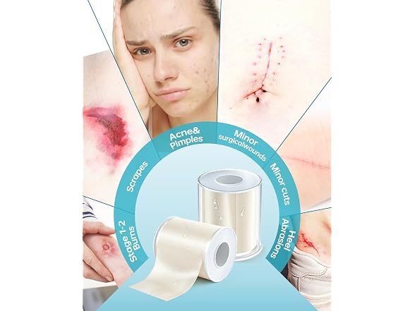Medical Grade Hydrocolloid Roll W/ Storage Case