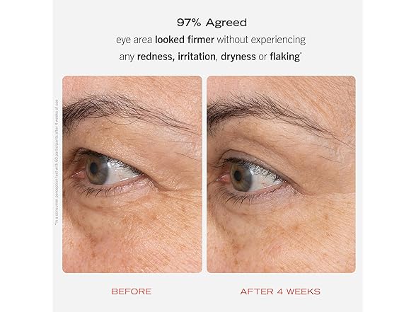 First Aid Beauty - Retinol Eye Cream