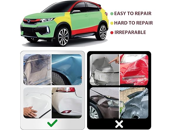 Hurrikom Dent Puller Suction Cup Kit
