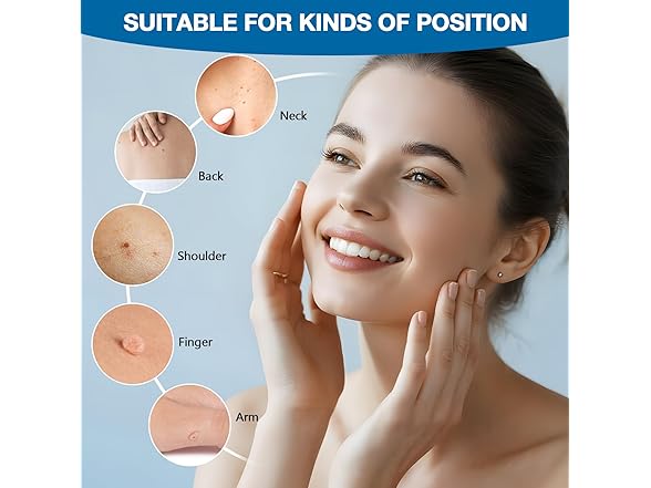 Wart Remover Patches 144 Patches