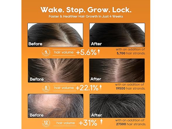 Folivive Hair Growth Serum Oil for Women