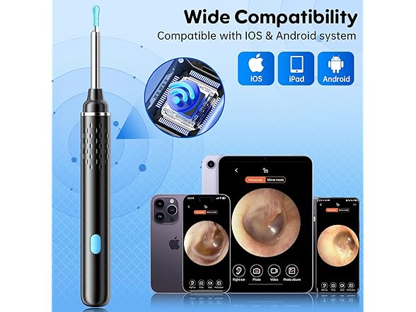 Coonyes Ear Wax Removal Tool with Camera