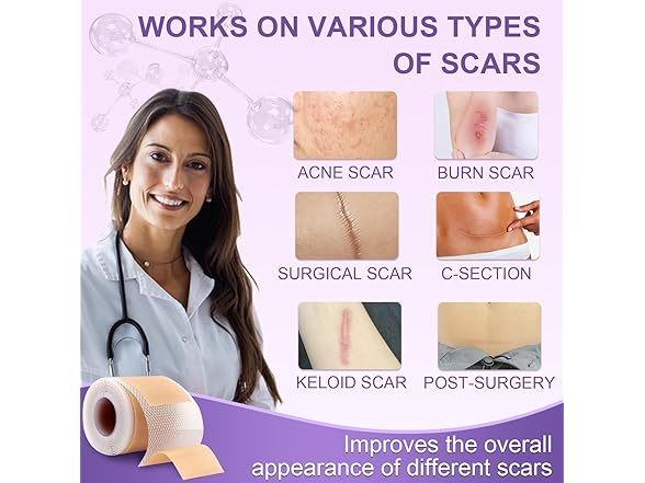 LUXEFUS Silicone Scar Tape