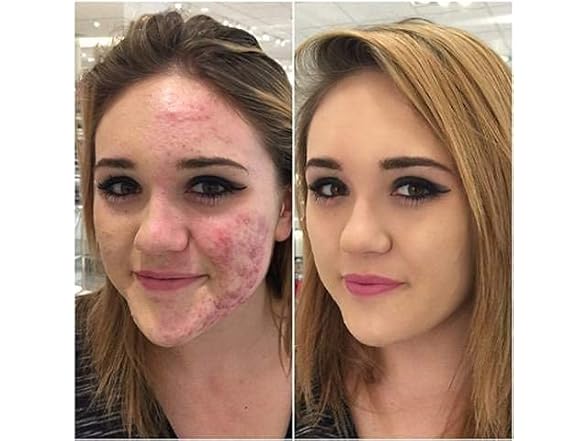 Glamza Phoera Foundation Set