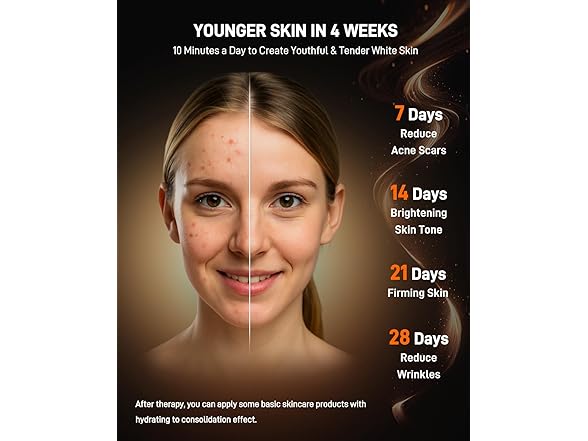 MICEYLIVE Red Light Therapy Mask for Face