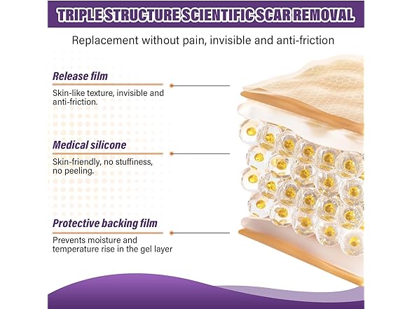 Silicone Scar Sheets (1.6"X59" Roll-1.5M)