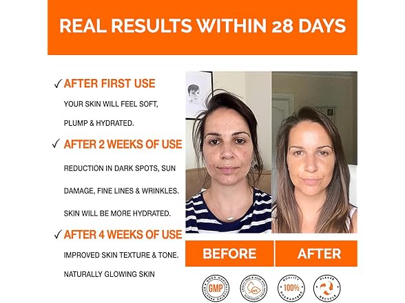 ViolaSkin Vitamin C Serum